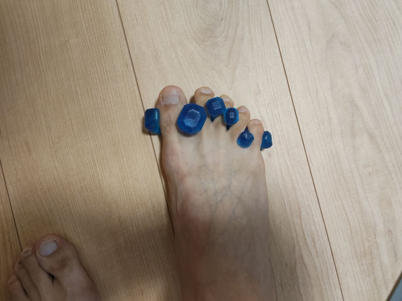 足指セパレータを装着した足。5本の指がしっかり広がっている